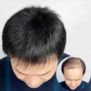 icon Chinese Hair Patch