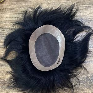 Model-1 Hair Patch